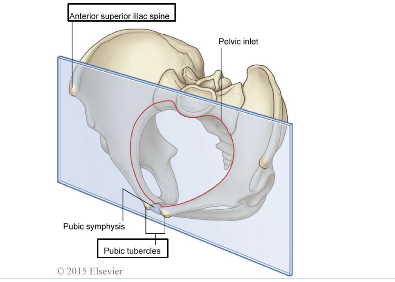 <p><span><span>Anterior superior iliac spine </span></span></p><p><span><span>Pubic tubercle</span></span></p>