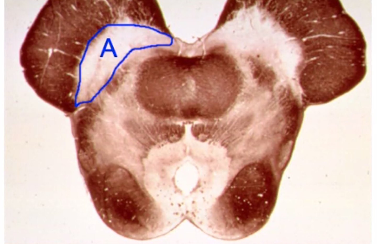 <p>Identify the structures indicated by the outline and letter "A"</p>