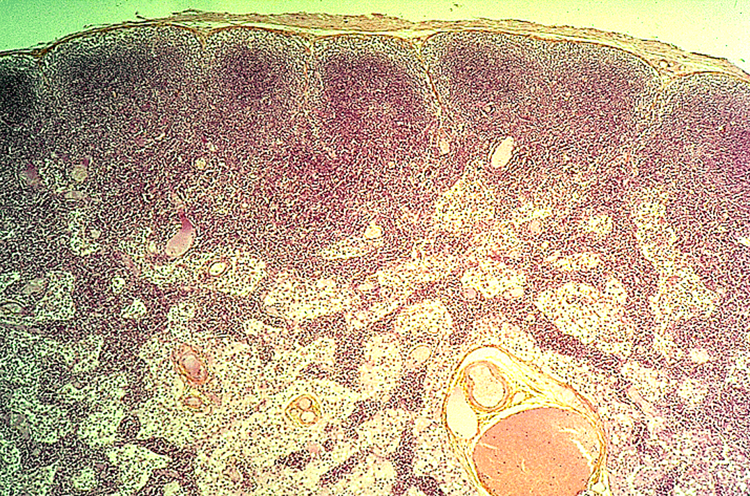 <p><strong>Lymph Nodes</strong></p><p>Dark-staining outer cortex, lymphatic nodules and  sub-capssular sinus below the capsule observed</p>