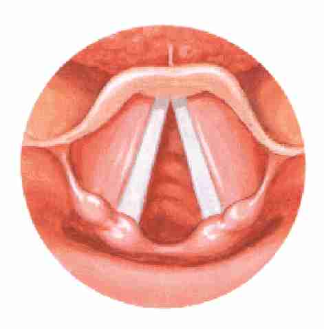 <p>vocal folds during regular breathing</p>