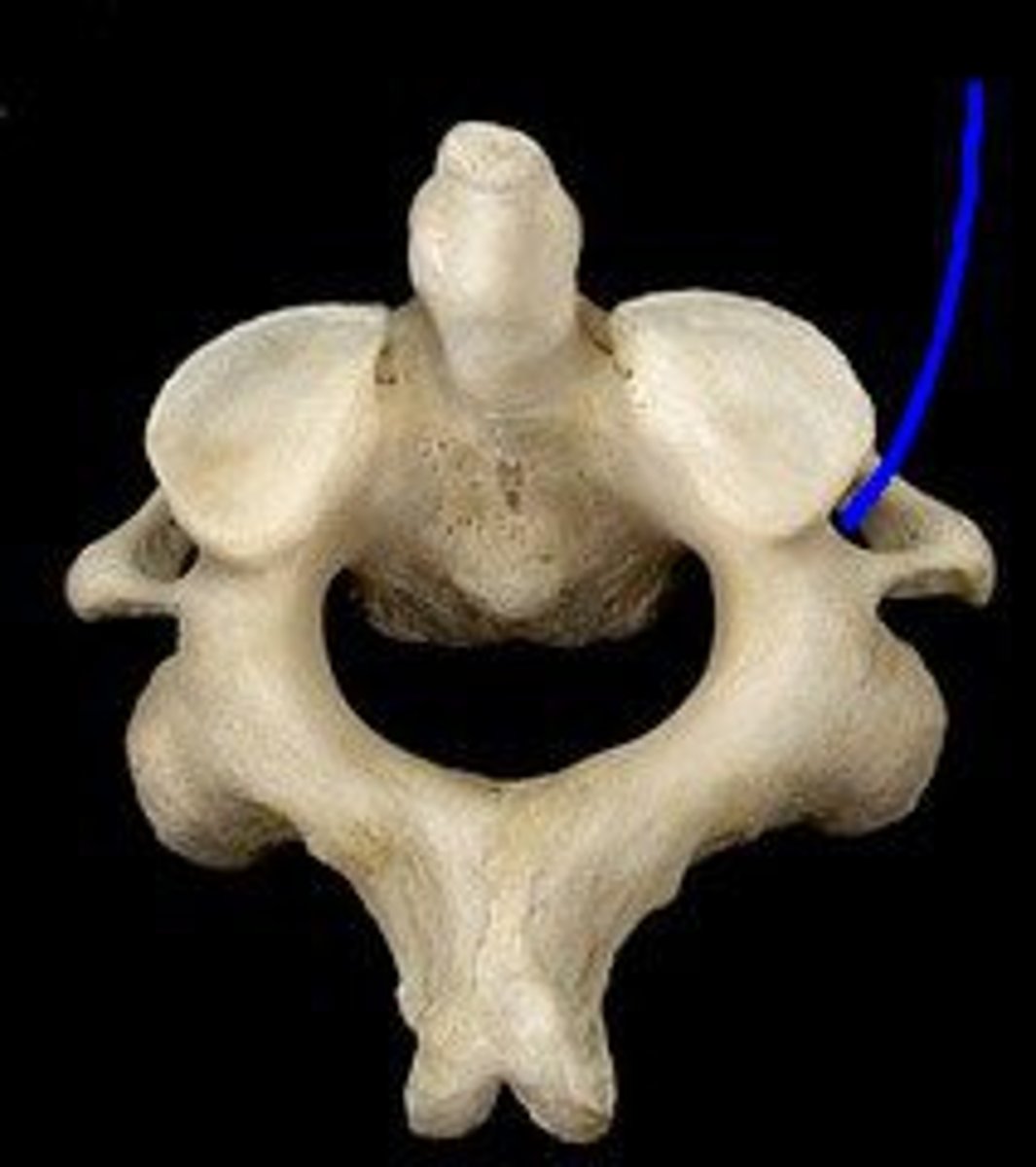 <p>ID the opening and bone</p>