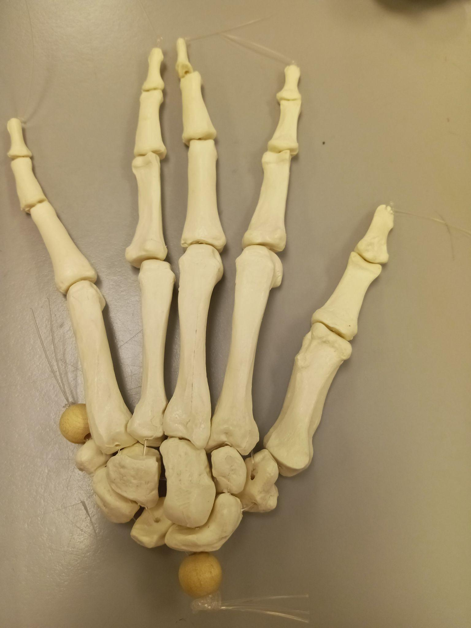 <p>Metacarpals (Bone Numbers)</p>