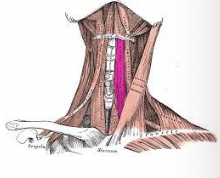 <p>What muscle is this?</p>
