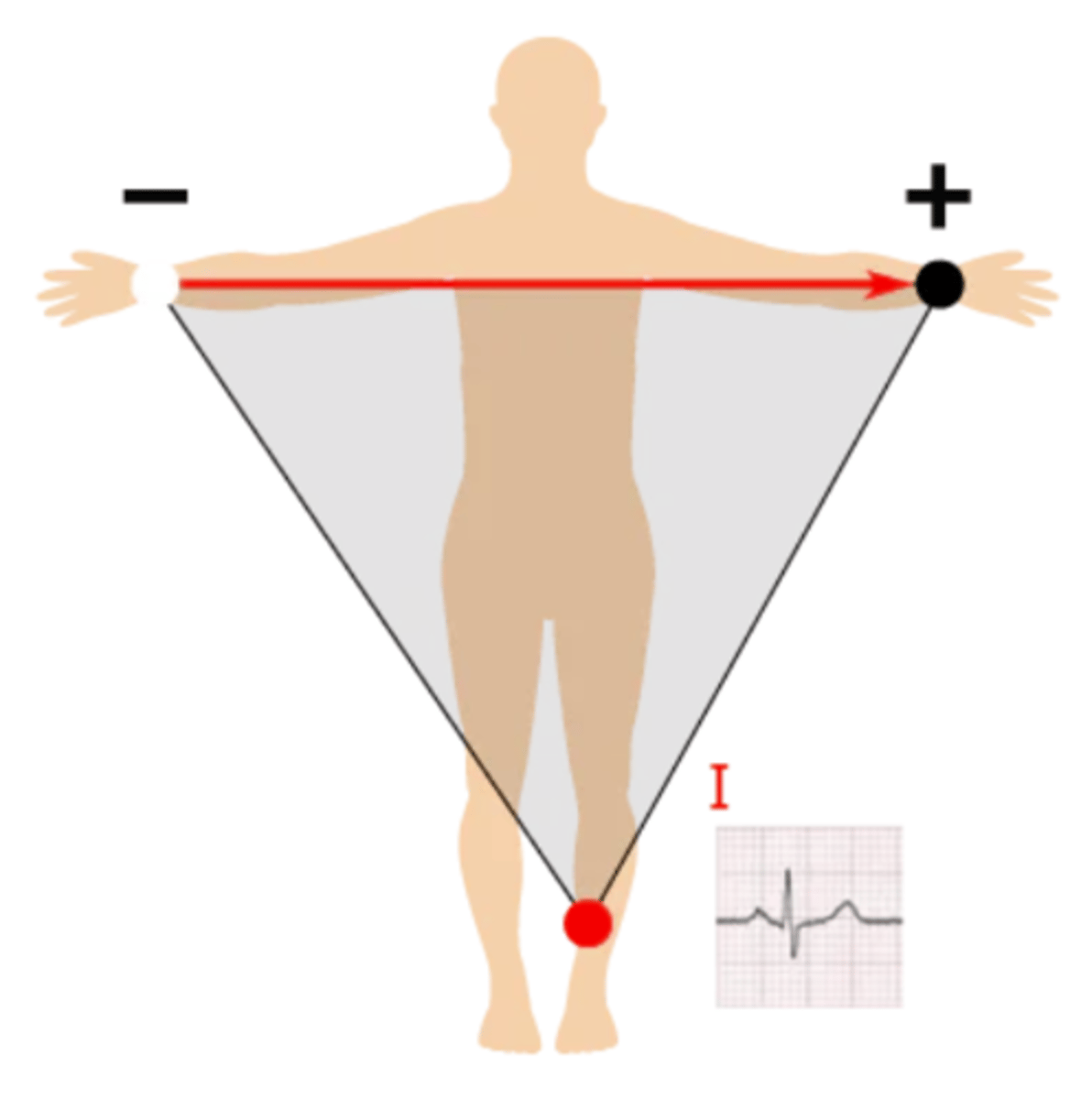 <p>Right arm --> left arm; produces a positive waveform as heart's electrical activity naturally moves down &amp; to the left</p>