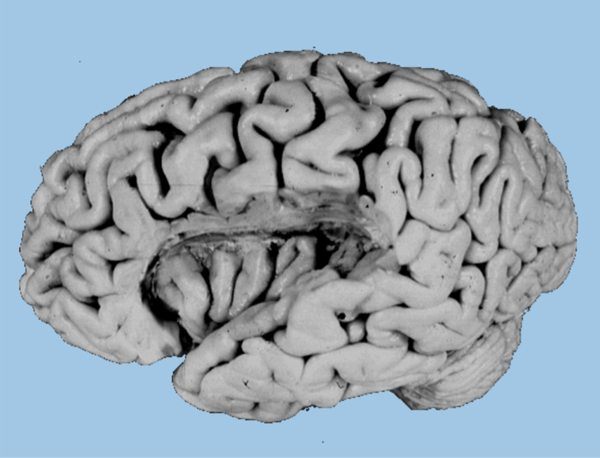 <ul><li><p>Lobe covered by frontal, parietal and temporal lobe (covering parts termed the operculum)</p></li><li><p>Strongly involved in sensory processing</p></li></ul><p></p>