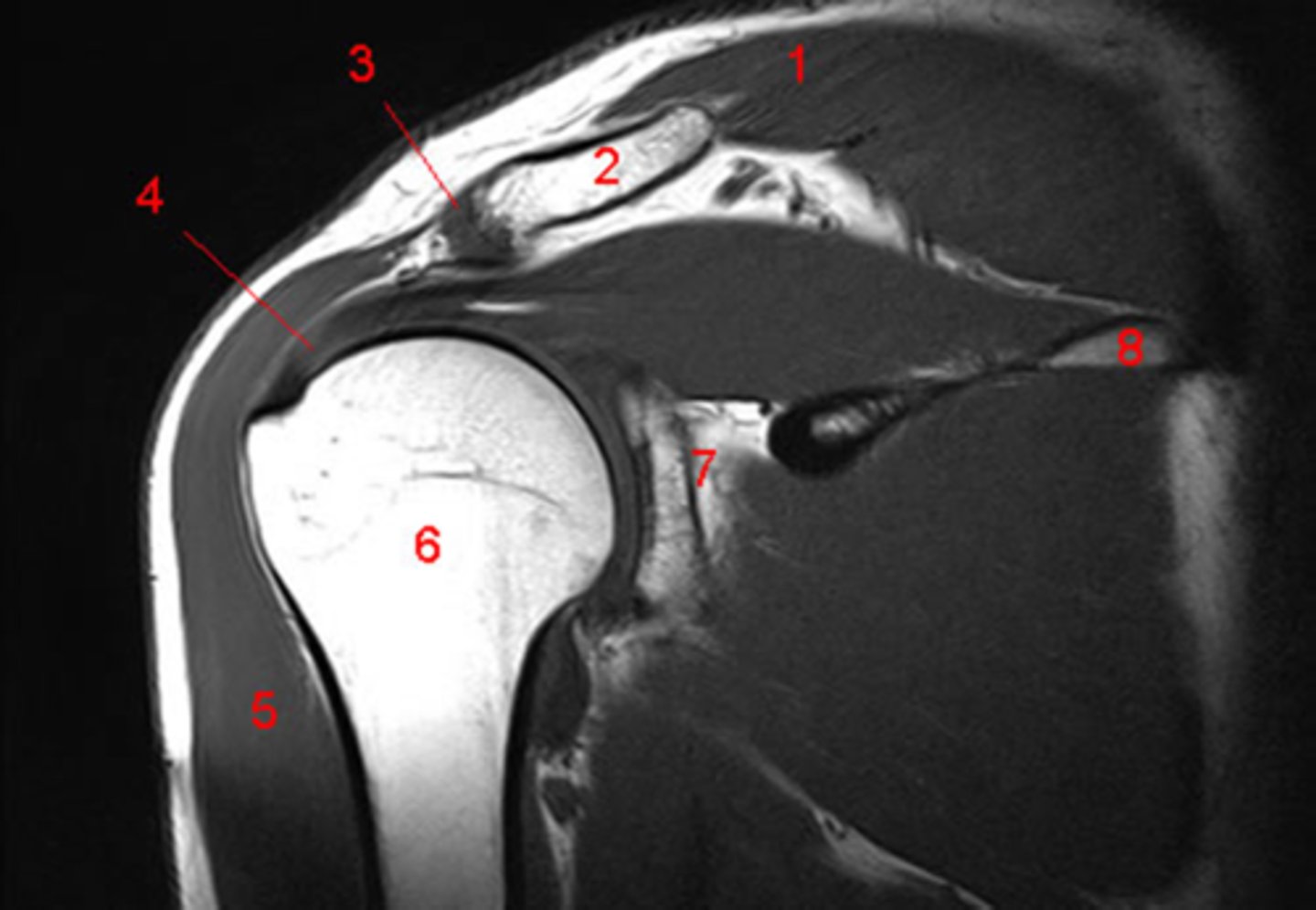 <p>see GH joint and AC joint</p>