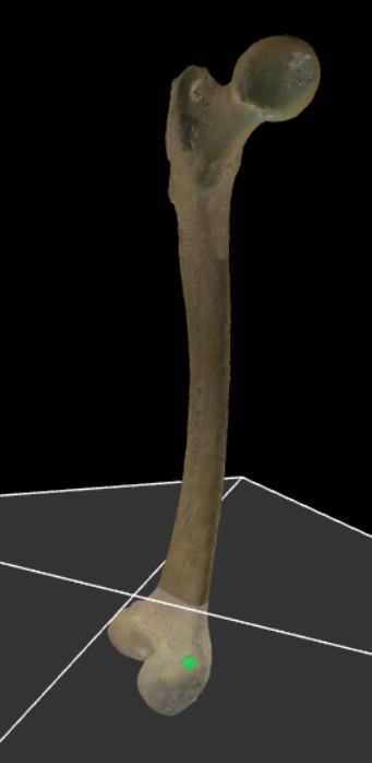 <p>Knobbeltje craniaal op de epicondylus medialis.</p>