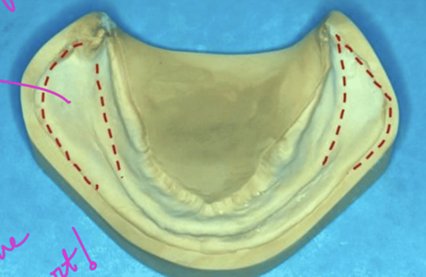 <p>what is outlined? the size of the outline (access) is determined by what? What type of area is this?</p>