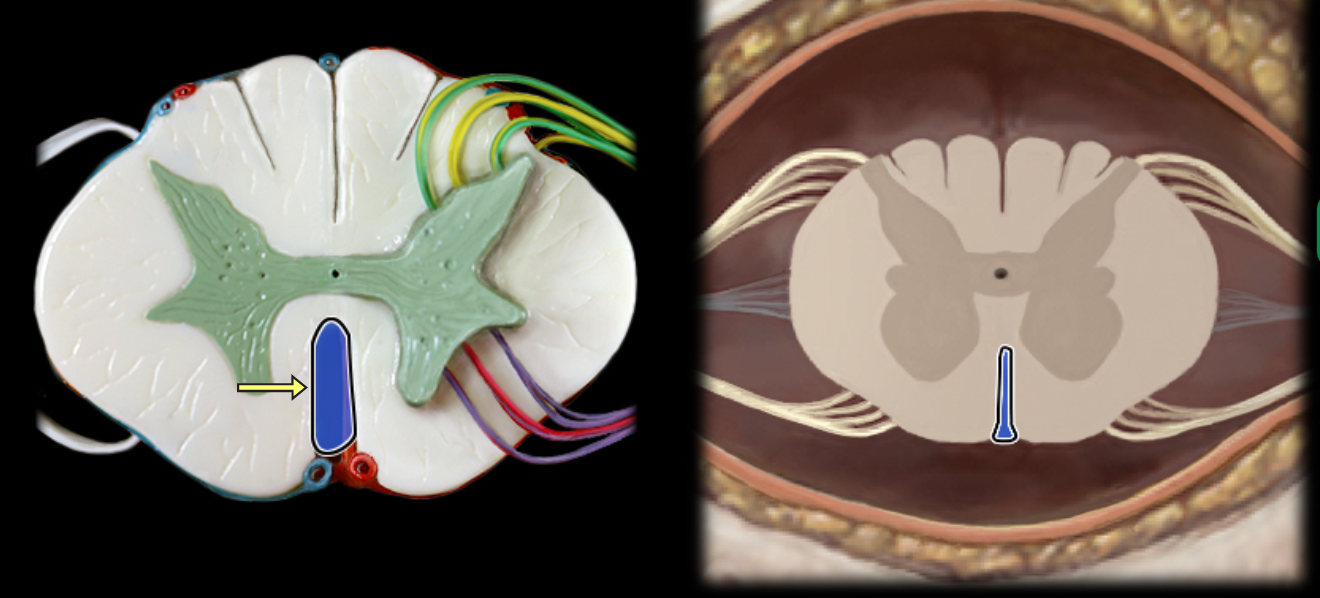 <p>Ventral median fissure</p>