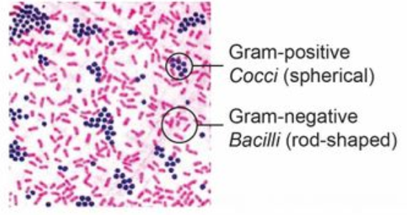 <p>NOTE: short rods can be mistaken for cocci; gram negative cocci are rare, it&apos;s probably a dehydrated rod</p>