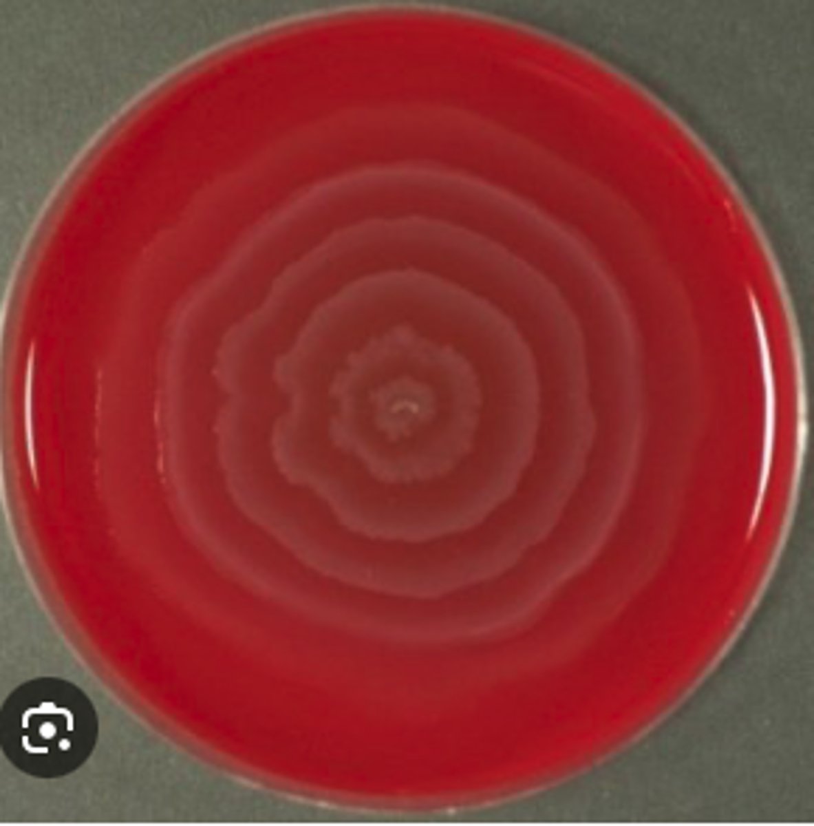 <p>A dog with chronic otitis externa has foul-smelling brown discharge. </p><p>Tests:</p><p>Cytology :Gram-negative rods</p><p>MAC is non-lactose fermenting </p><p>Urease Positive </p><p>*See BA plate </p>