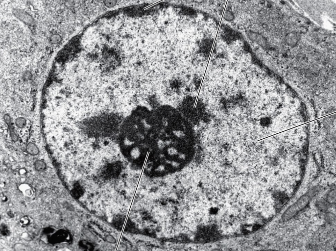 <p>where does heterochromatin located?</p>