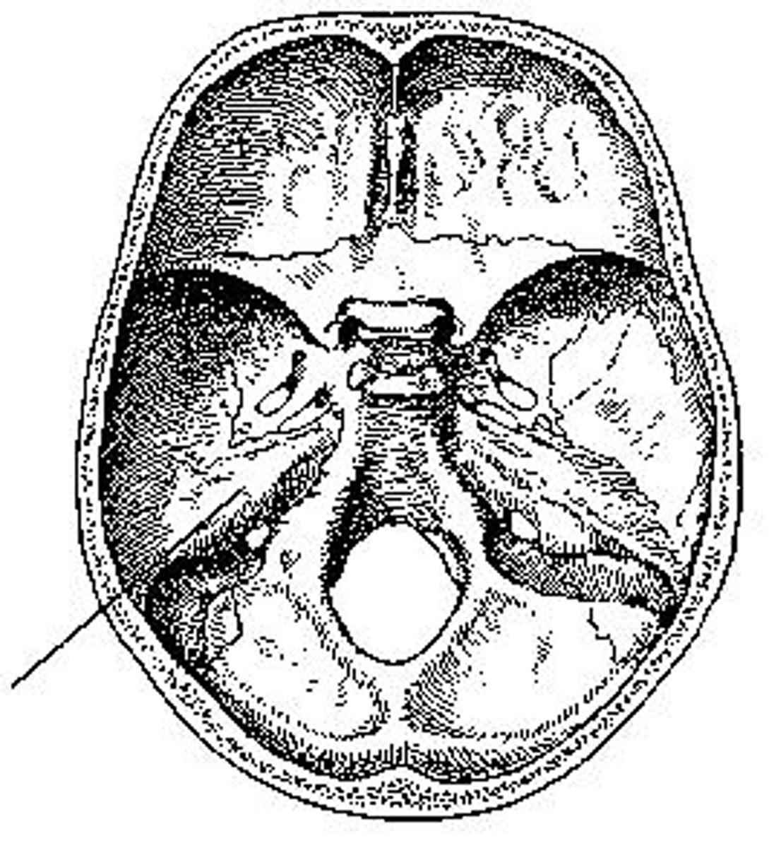 <p>What part of the cranial base is identified?</p>