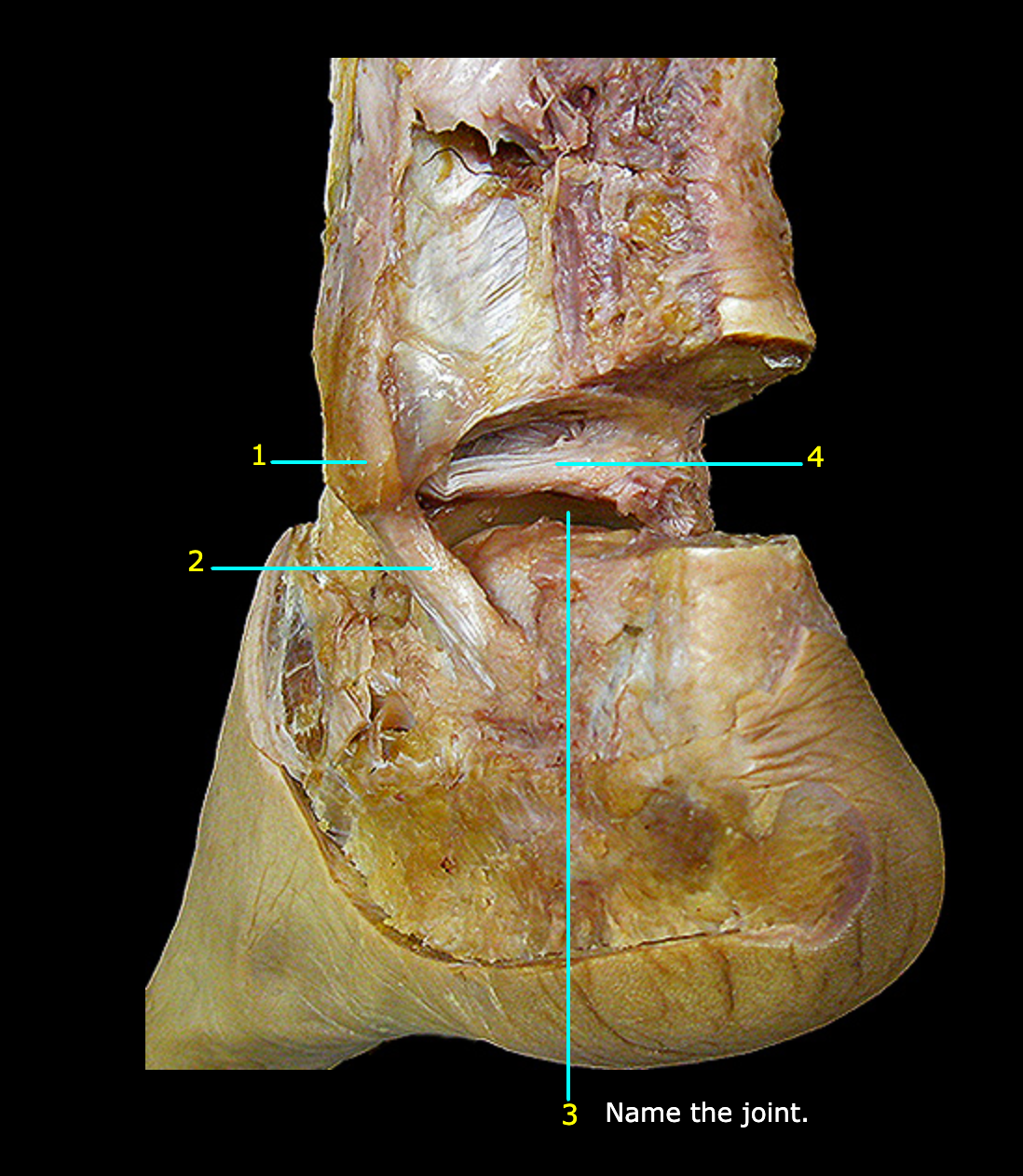 <p>What structure is labeled 4?</p>