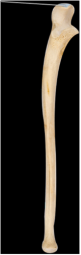 Which of the following muscles inserts on the highlighted structure?