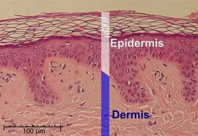 <p>epidermis</p>