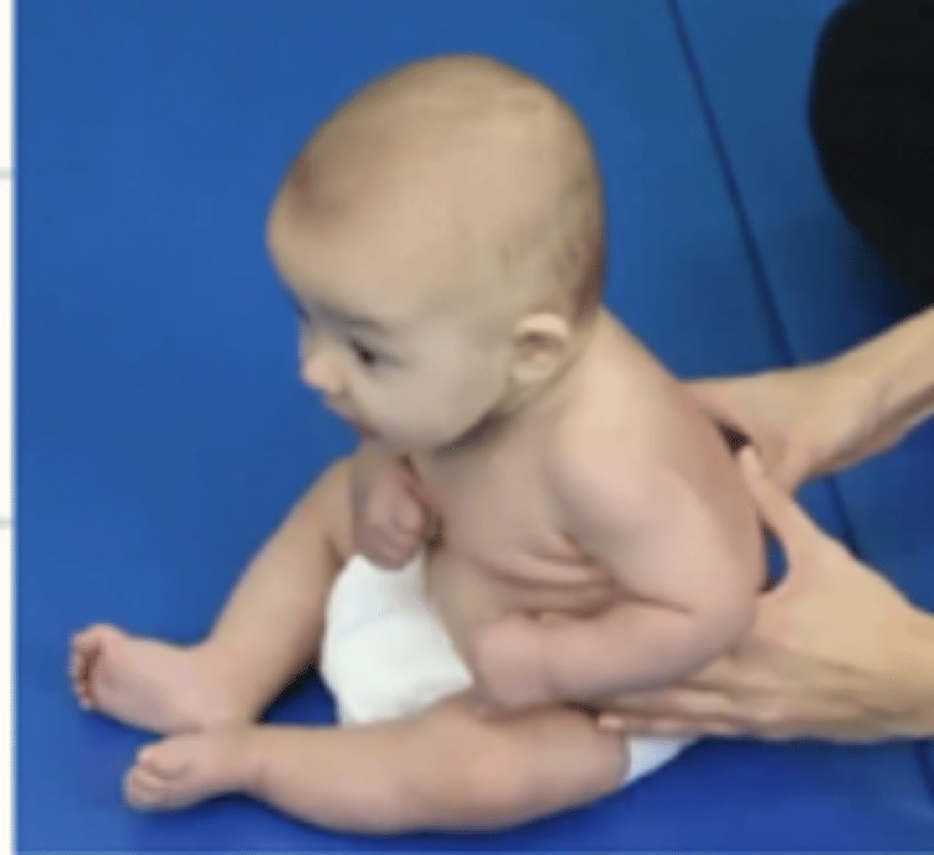 <p>LEs are positioned into EROT and abduction</p><p>Back is more extended in sitting</p><p>Baby's weight is on the ischial tuberosities</p><p>Less support during sitting - if the baby feels unstable they will use bilateral scapular adduction or high guard position to maintain balance</p><p>Trunk control is building so if the baby is left unsupported for too long, the baby will fall forward</p>