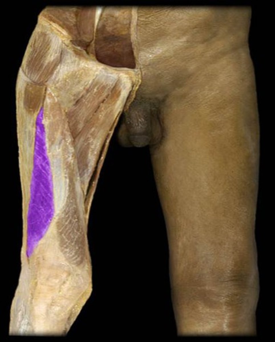 <p>via common tendinous (quadriceps tendon) and independent attachments to base of patella; indirectly via patellar ligament to tibial tuberosity; medial and lateral vasti also attach to tibial tuberosity; medial and lateral vast also attach to tibia and patella via aponeuroses (medial and lateral patellar retinacula)</p>