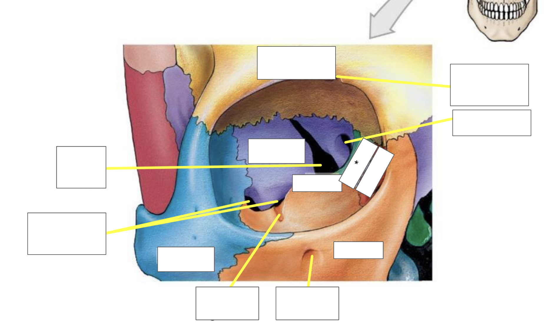 term image