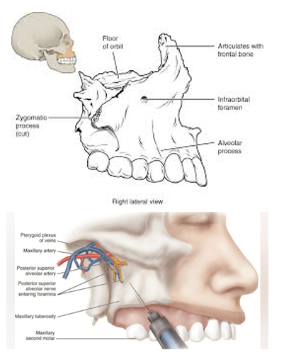 <ul><li><p>2 fused bones at intermaxillary suture</p></li><li><p>infraorbital foramen</p></li><li><p>canine fossa (depressions)</p></li><li><p>canine eminece (raised protrusion)</p></li><li><p>maxillary tuberosity</p></li><li><p>posterior superior alveolar foramina</p></li><li><p>incisive foramen</p></li><li><p><strong>forms the floor of the nasal cavity</strong></p></li><li><p><strong>contains maxillary (upper) teeth</strong></p></li></ul><p></p>