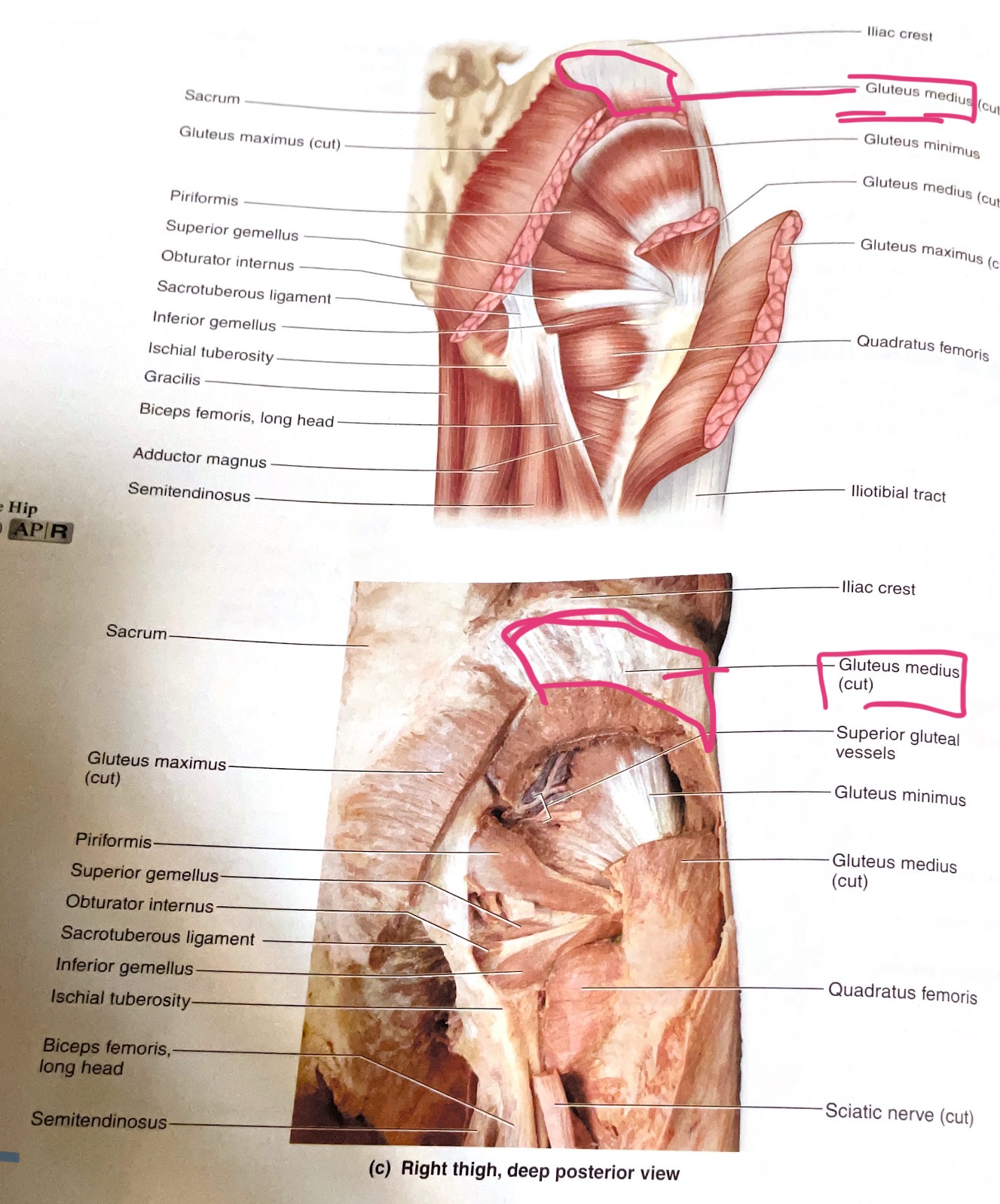 <p>Action: Abduct hip(move away from body midline )</p>