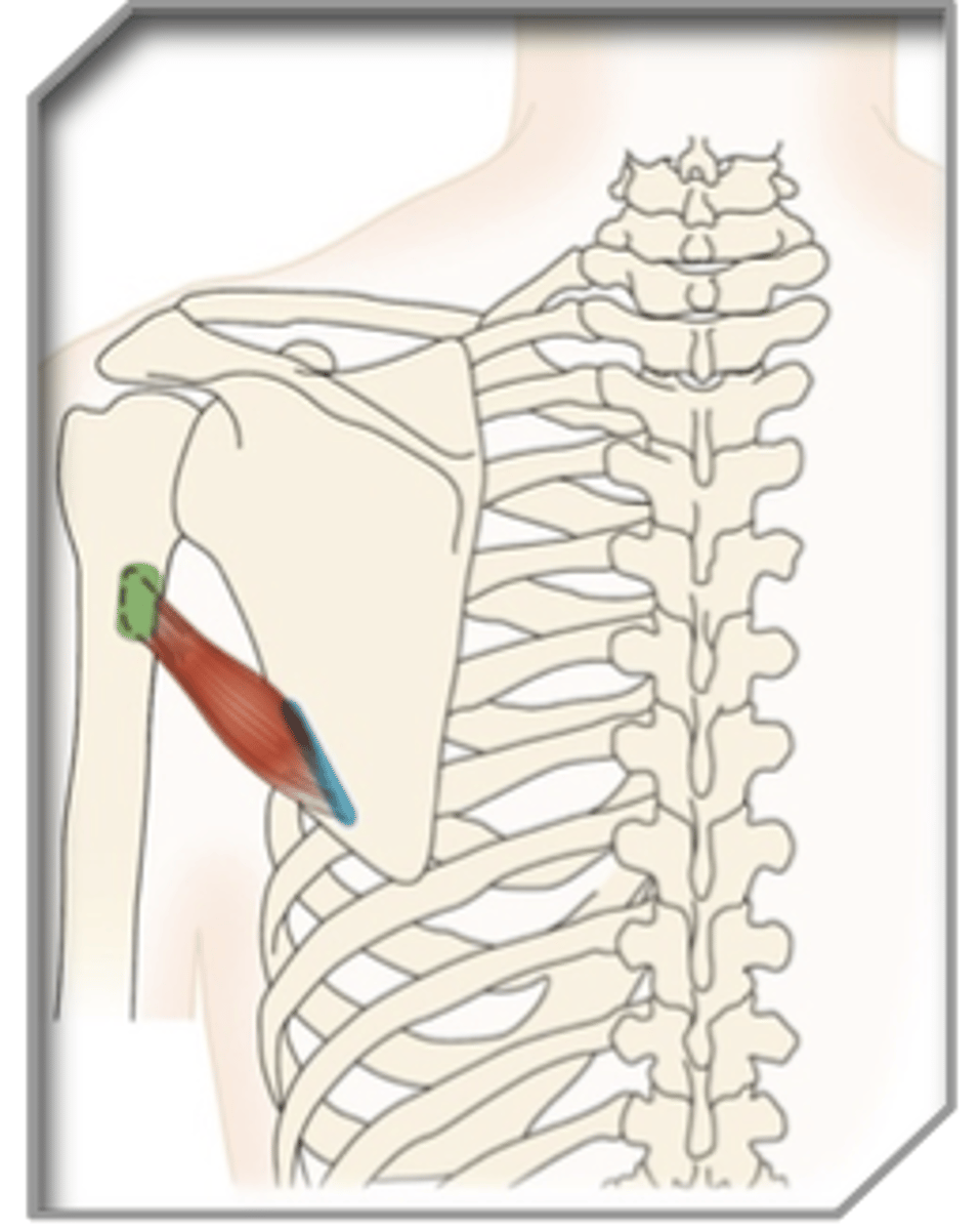 <p>What muscle is this?</p>
