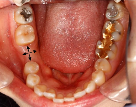 <p>What are components of a site specific clinical evaluation?</p>