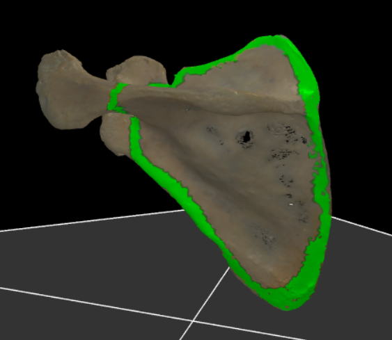 <p><span>volledige achterzijde van de scapula</span></p>