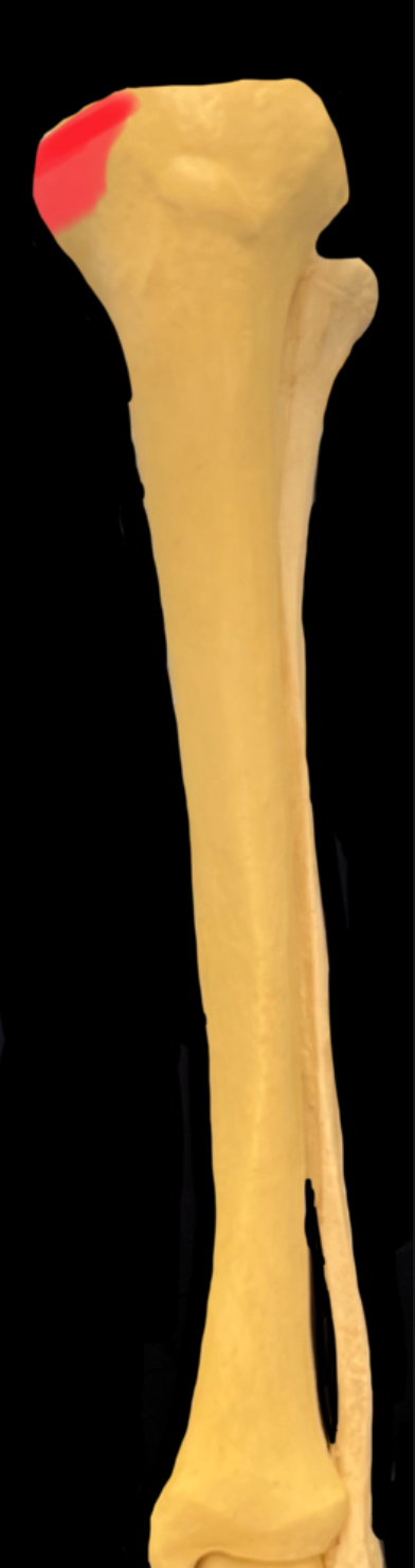 What is highlighted in red?

What muscle inserts here?