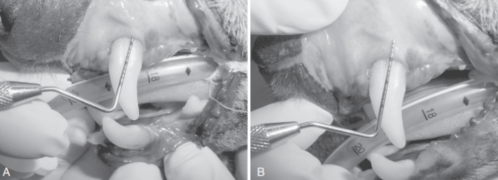 <p>Based on this picture, what is the measurement of the gingival sulcus of this patient?</p>