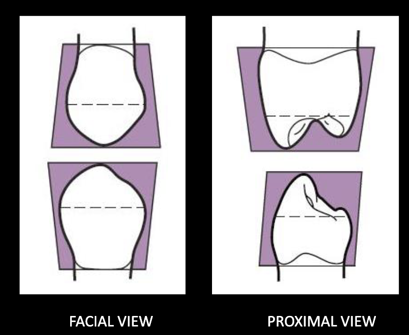 <p>rhomboid</p>