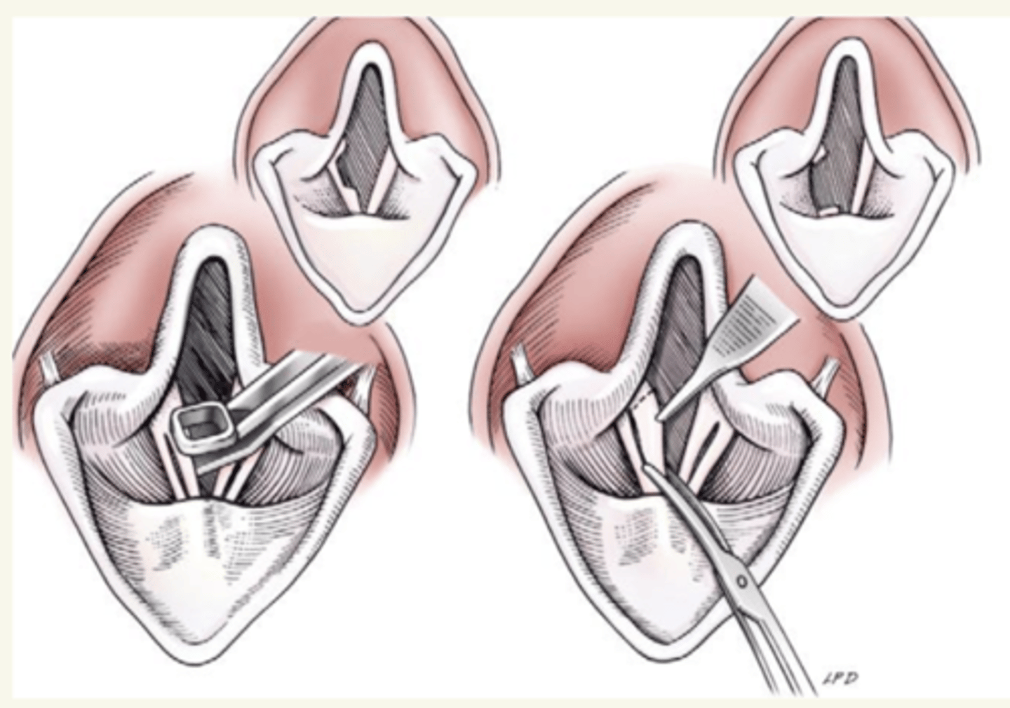 <p>oral</p>