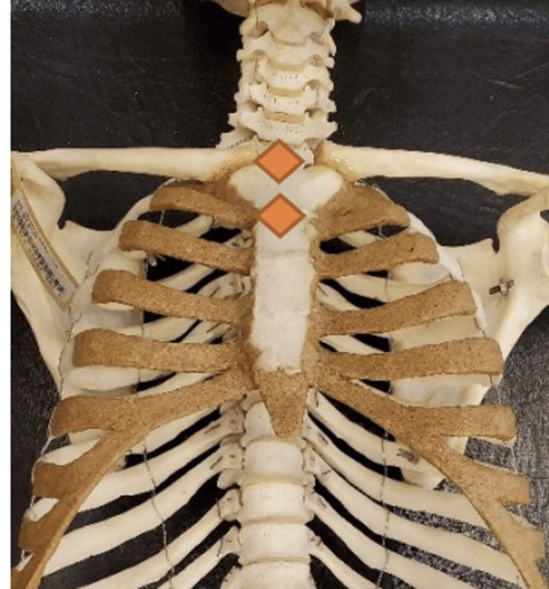 <p>sternal notch</p>