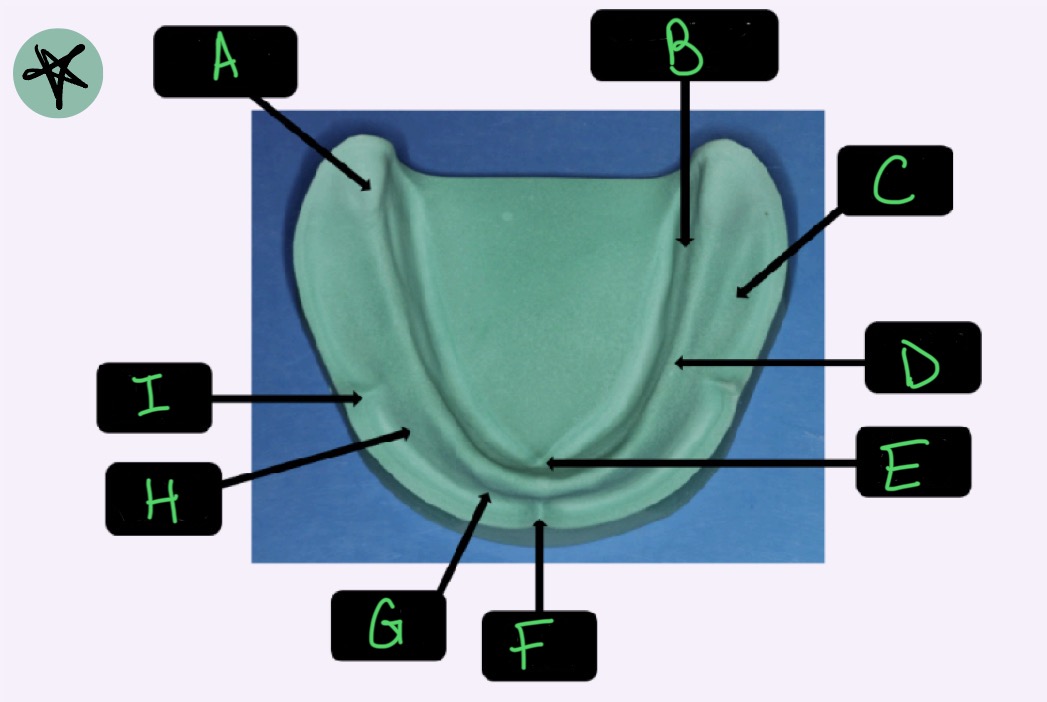 <p>What structure is labeled A?</p>