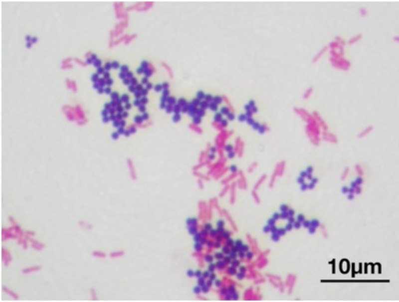 <p>considering that the cell wall of bacteria is negatively-charged, both Crystal Violet and Safranin dyes can be classified as: (select all that apply)</p><p>a. basic dyes</p><p>b. acidic dyes</p><p>c. positive stains</p><p>d. negative stains</p>
