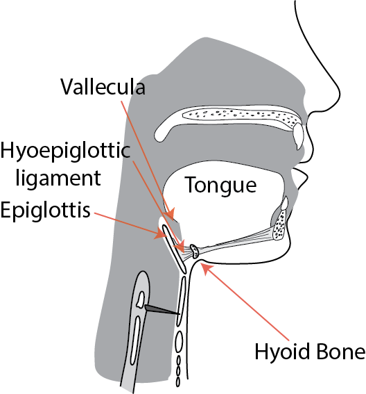 <p>label connection between epiglottis and hyoid bone - is it extrinsic or intrinsic?</p>