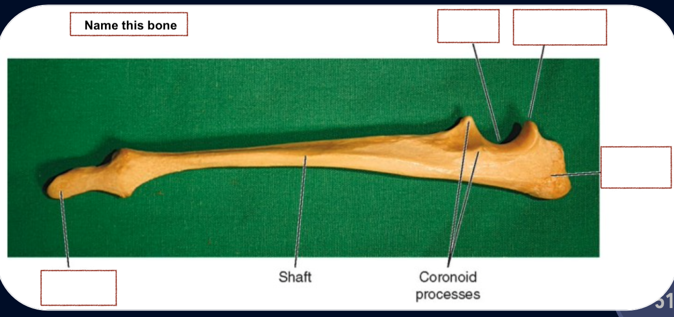 <p>Tronchlear/Semilunar notch</p><p>Anconeal process</p><p>Olecranon process</p><p>Styloid process</p>