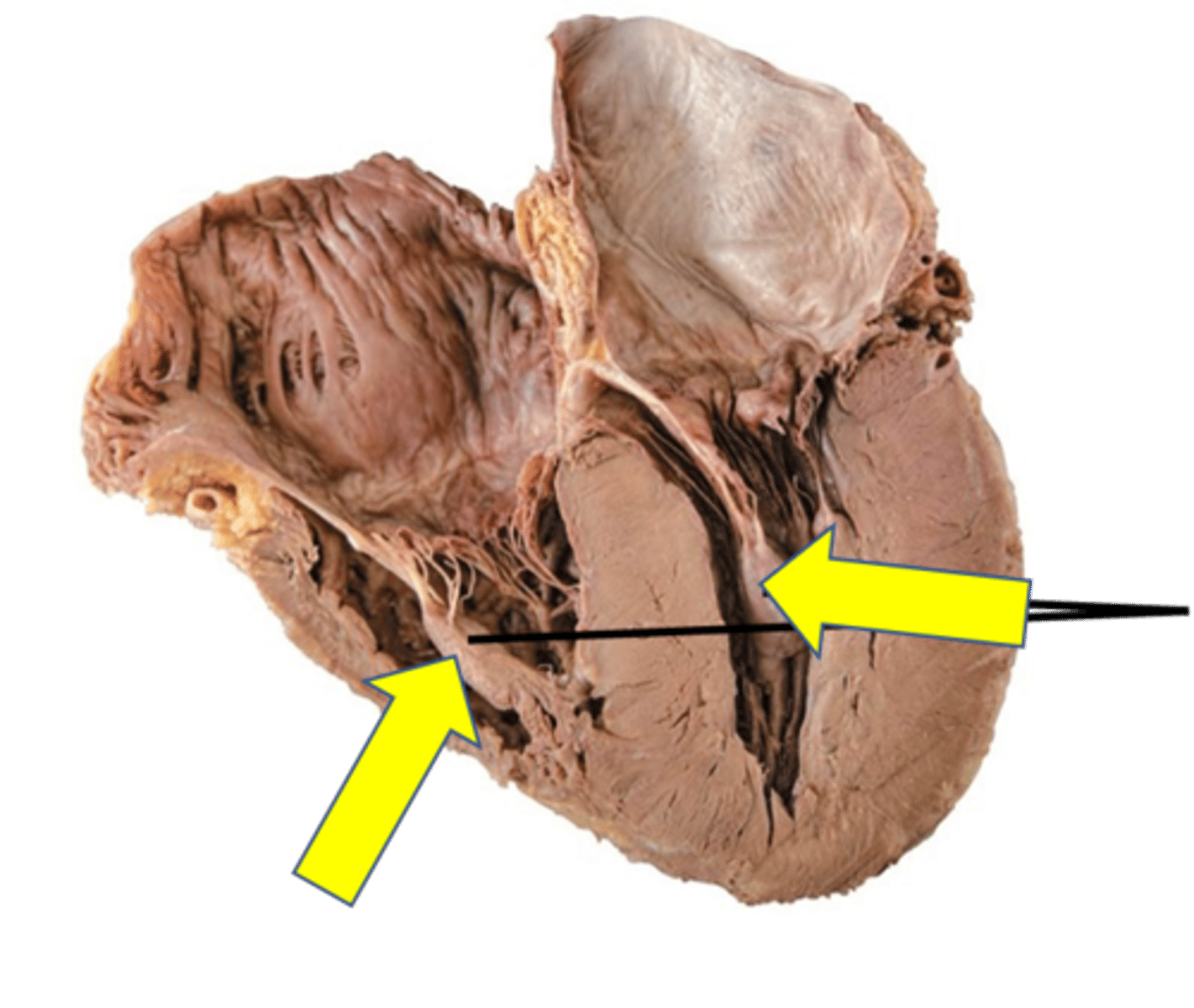 <p>Name the cone shaped structure.</p>