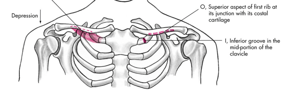 Stabilization & protection of the sternoclavicular joint