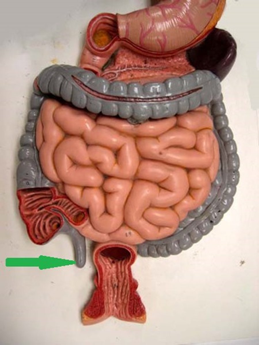 <p>- forst portion of the large intestine</p><p>- has an extension off of it called the VERMIFORM APPENDIX</p><p>(the image points to the vermiform appendix)</p>