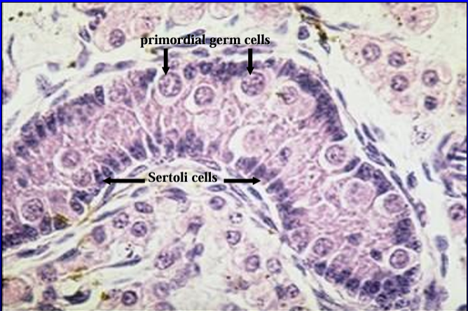 <p>Another view of the seminiferous tubule and the interstitial cells of the testis of 1-day-old pig.</p>