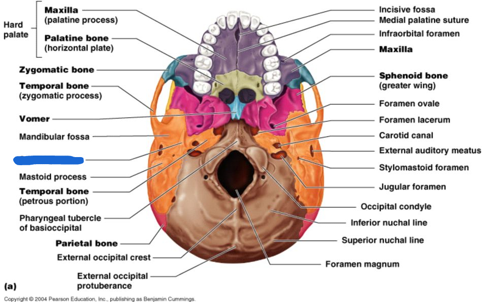 <p>styloid process (inferior view)</p>