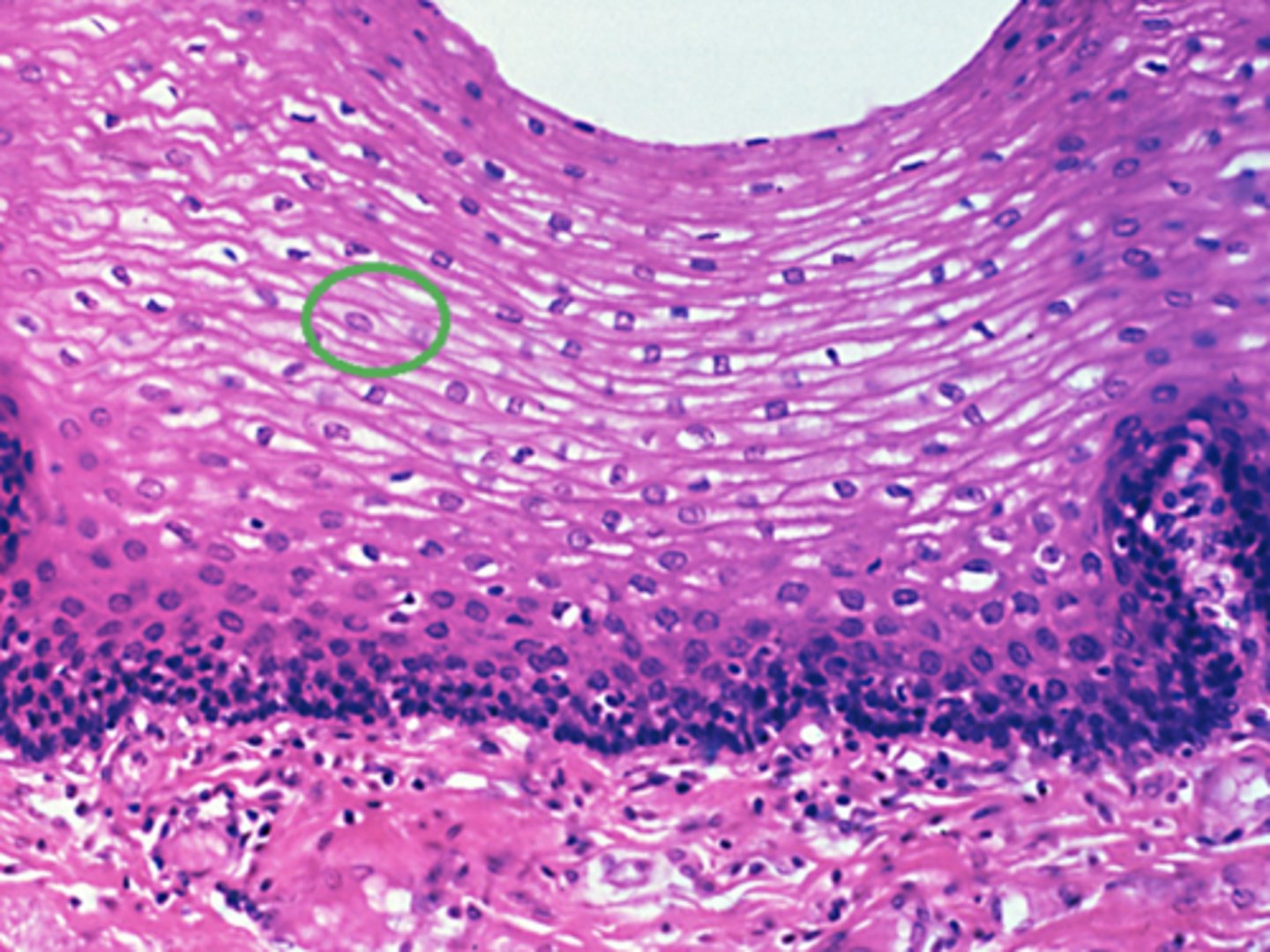 <p>Which cell type is circled in green in the this image of epithelial tissue?</p><p>Columnar</p><p>Squamous</p><p>Cuboidal</p>