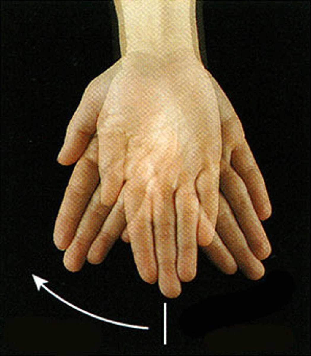 <p>radial deviation</p>