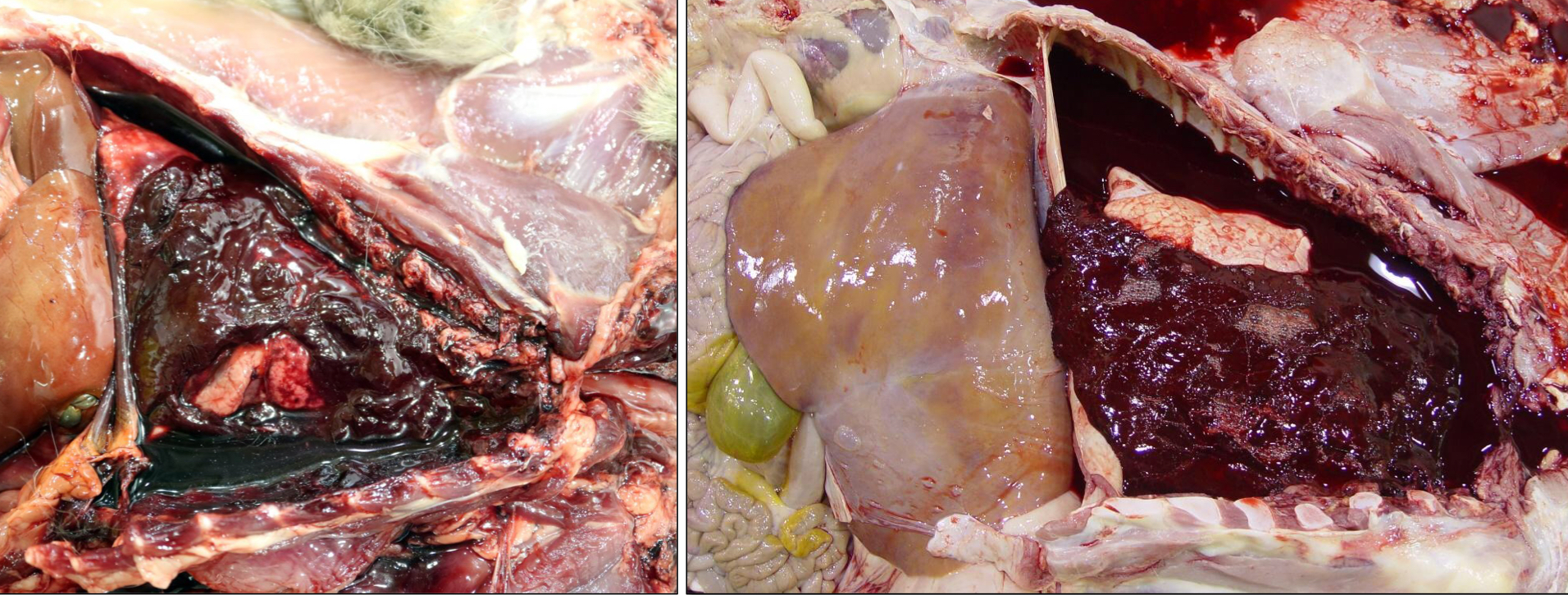 <p>Blood in the thorax (pleural cavity)</p>