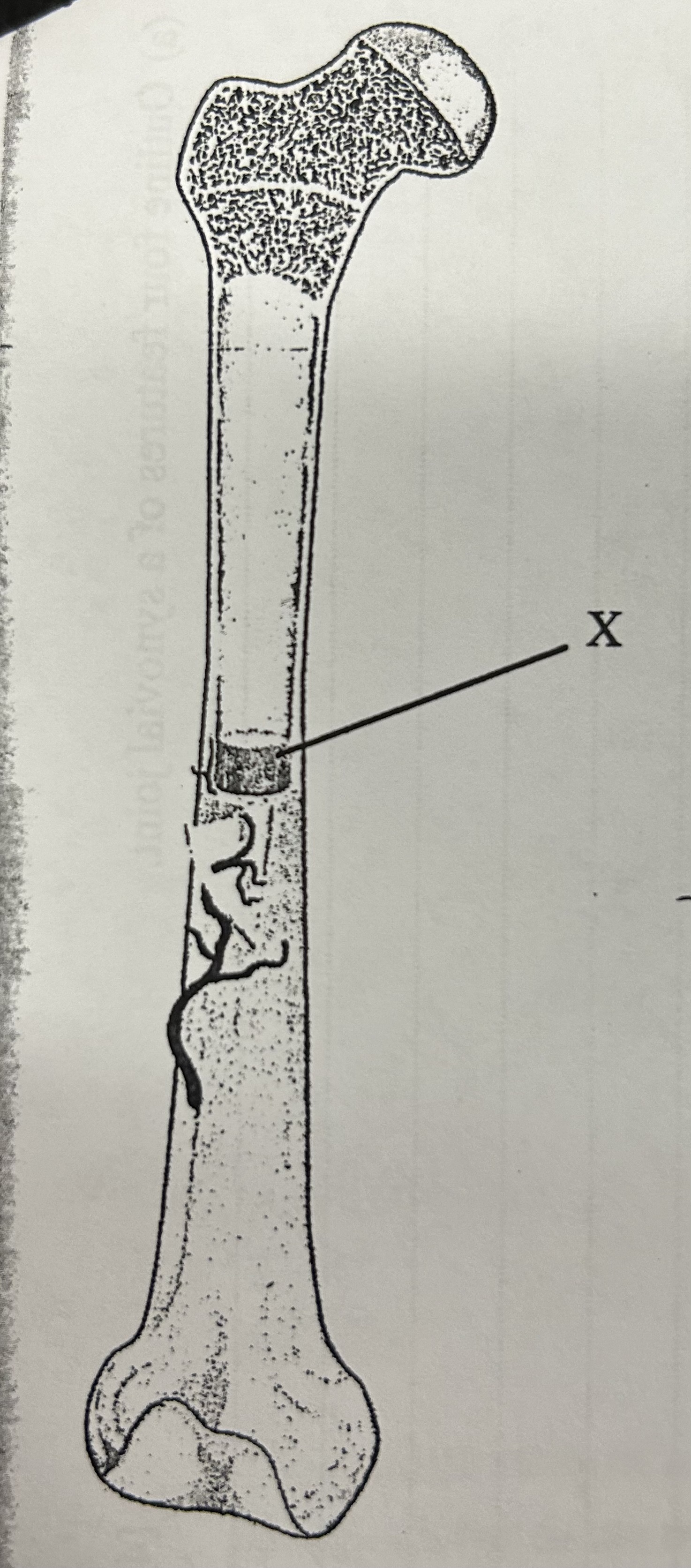 <p>Which part of the long bone is labelled X in the diagram? </p>