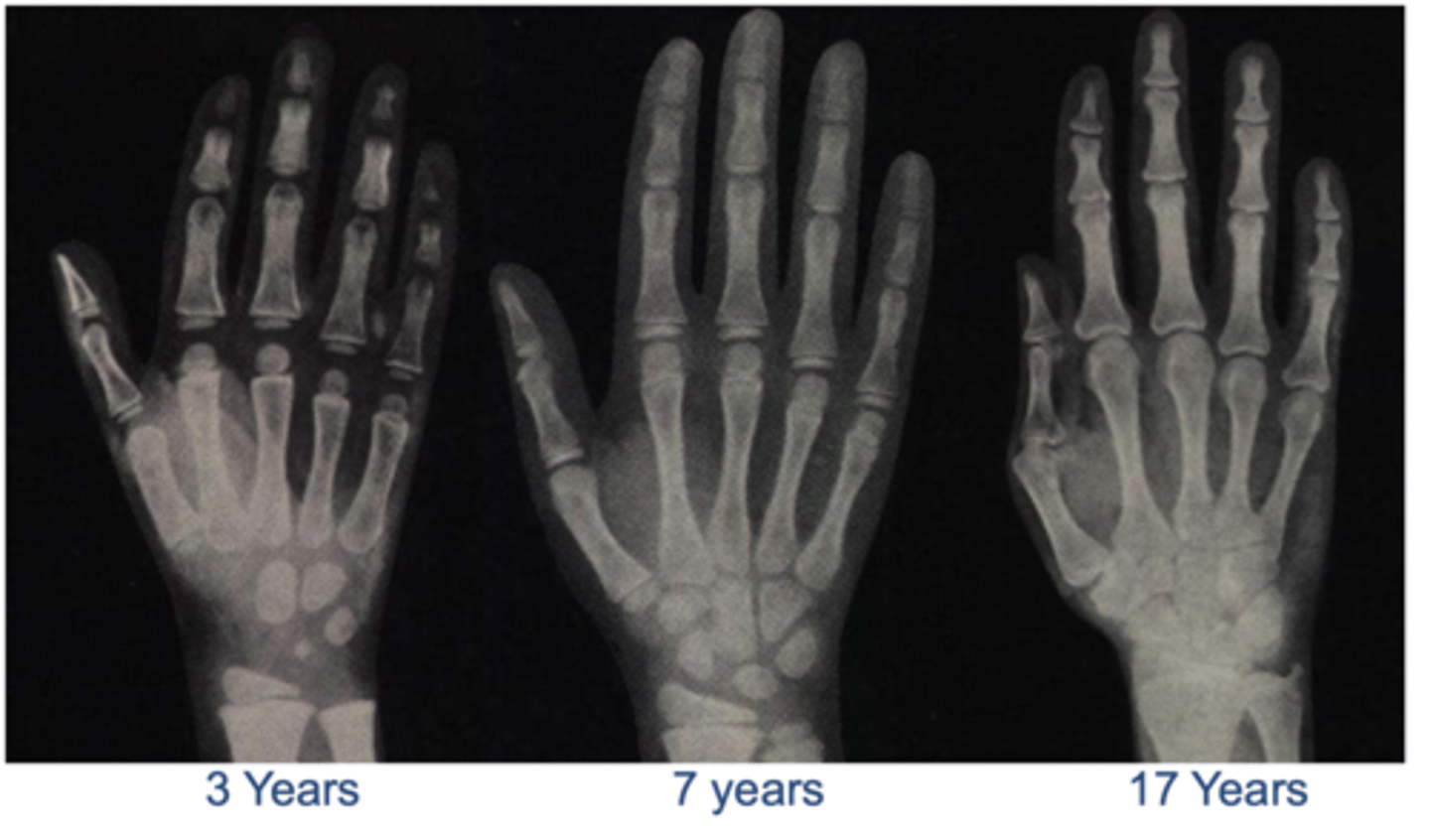 <p>gần tuổi nhau</p>