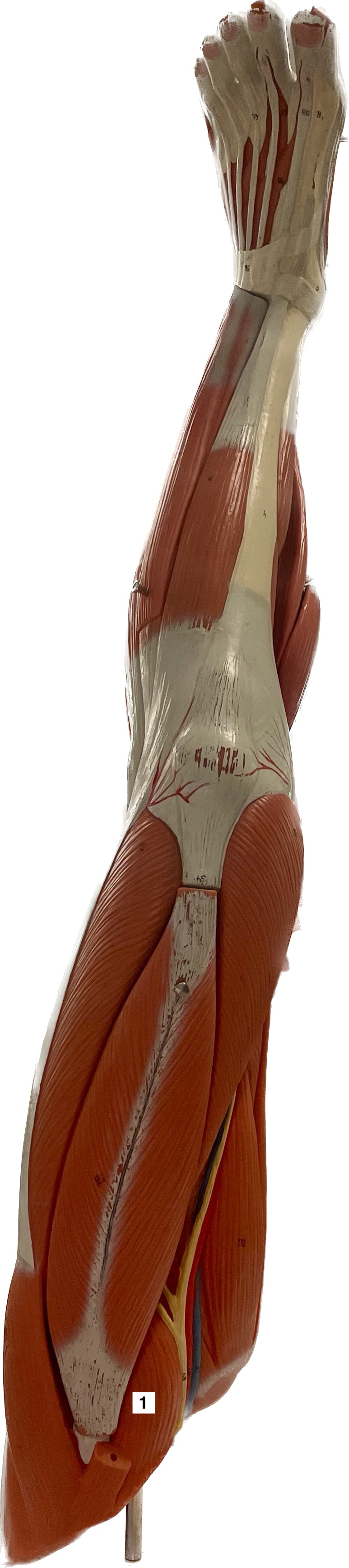 iliopsoas - flexes thigh