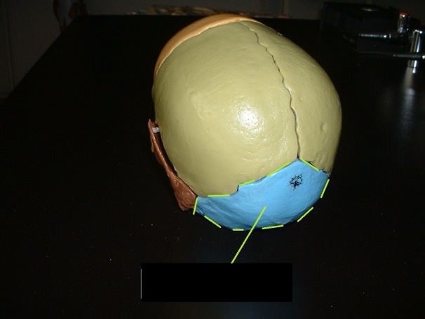 <p>the back of the head; inferior, posterior. it has a hole in the bottom that the spinal cord goes through (foramen magnum).</p>