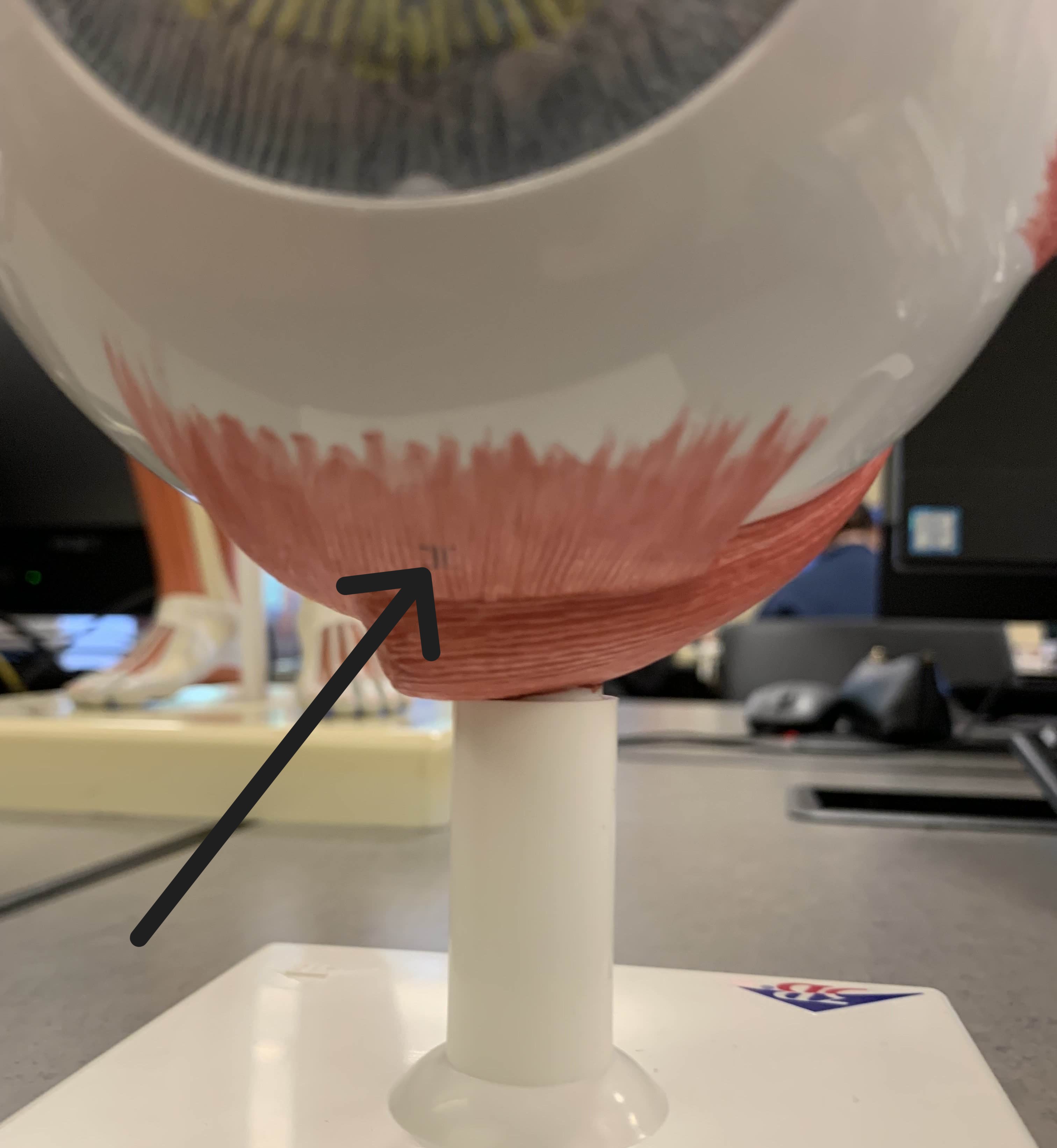 <p>Which muscle of the eye is:</p><ul><li><p>Located inferior to the pupil</p></li><li><p>Action: eye looks down</p></li><li><p>Nerve: <span style="color: yellow;">CN III</span></p></li></ul><p></p>